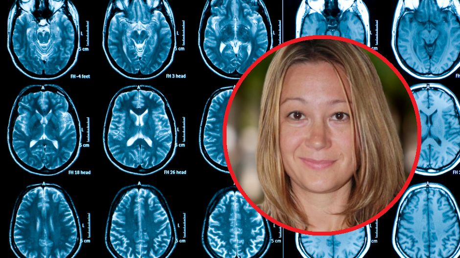 Co zwiększa ryzyko rozwoju demencji?