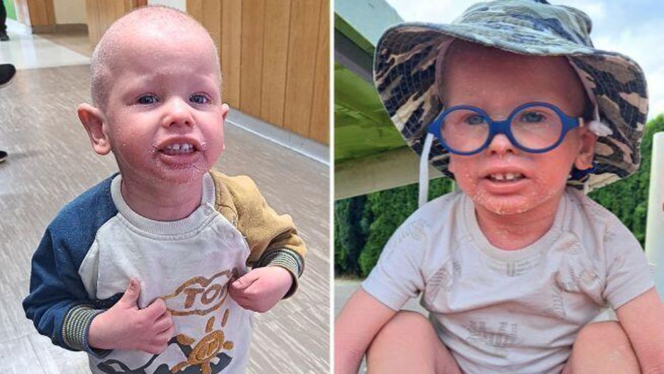 3-letni Staś od urodzenia walczy z bólem. Dramatyczny apel mamy