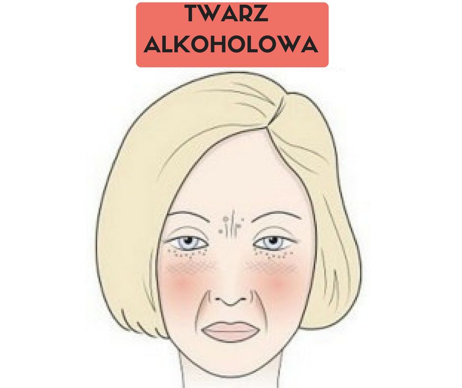 twarz alkoholowa