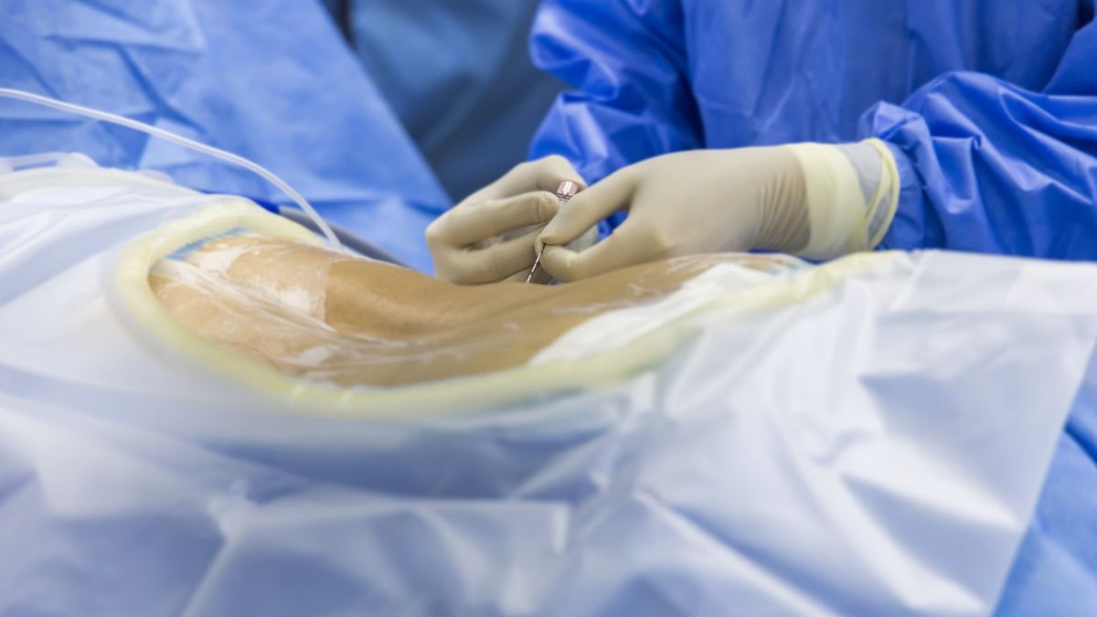 Badanie płynu mózgowo-rdzeniowego polega na pobraniu go przez wkłucie igły punkcyjnej do kanału kręgowego.