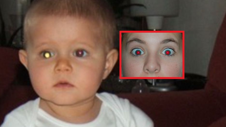 Zwróć uwagę na oczy dziecka na zdjęciach