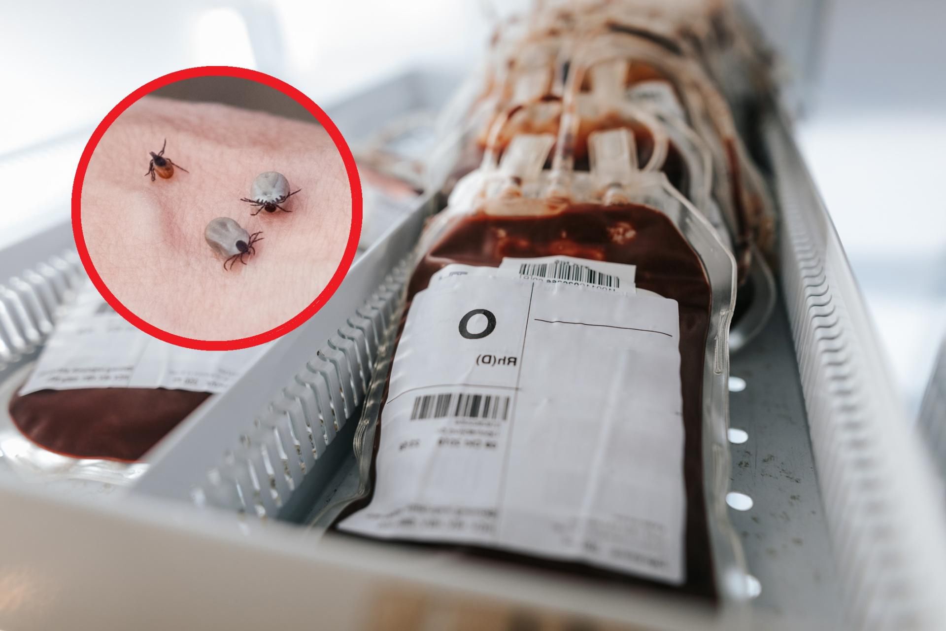 Osoby mające tę grupę krwi, są bardziej narażone na ataki kleszczy