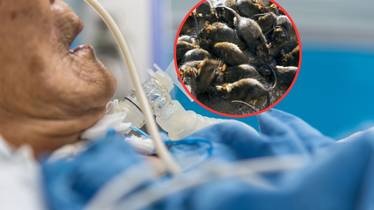 Dżuma płucna zabiła pacjenta z Arizony