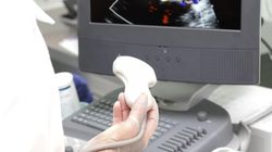 Jakie choroby może wykryć USG Dopplera?