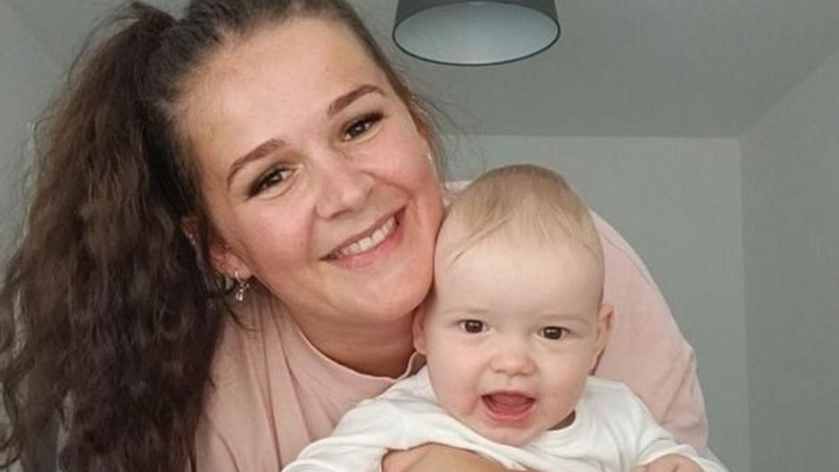 Urodził się z nietypowym kształtem głowy