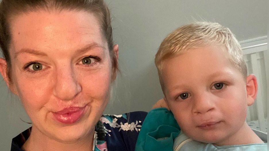 Jej syn urodził się z zajęczą wargą. Matka uważa, że odziedziczył to po niej