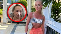 Koszmar zaczął się na wakacjach. 22-latka otarła się o śmierć z powodu martwicy trzustki