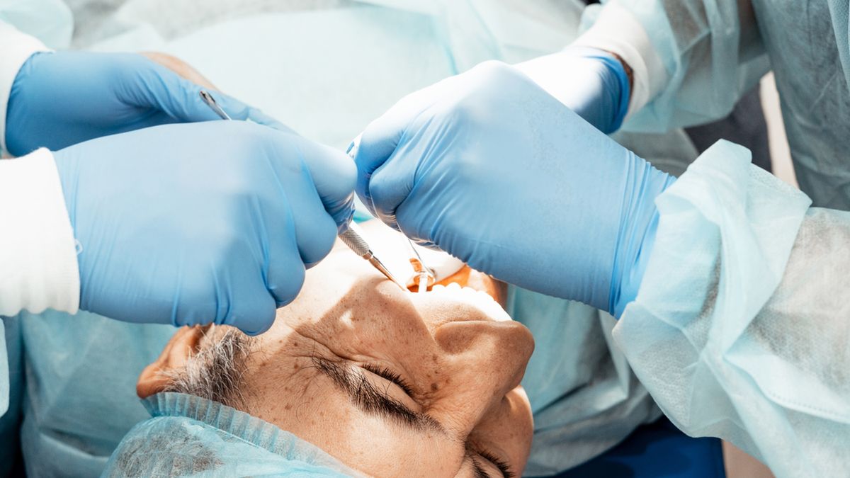 Ekstrakcja zęba to całkowite usunięcie zęba z zębodołu