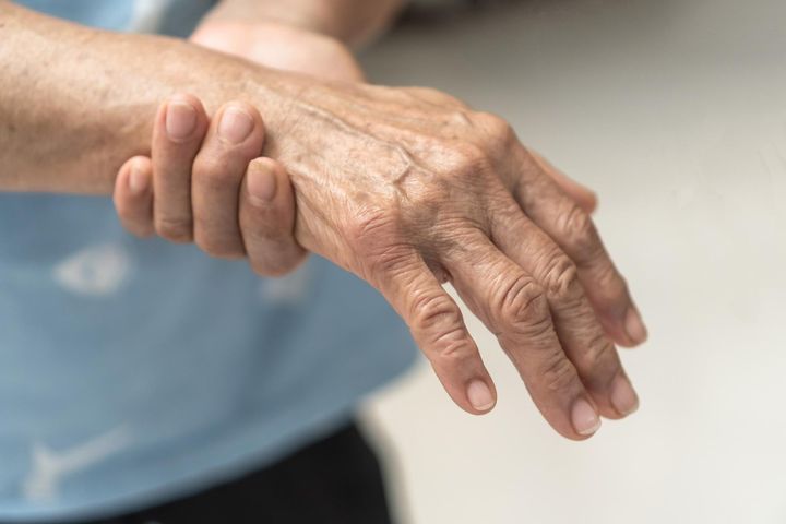 Badania pokazują, że choroba Parkinsona nawet przez kilkanaście lat rozwija się w ukryciu
