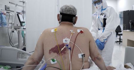 Cicha hipoksja częściej może wystąpować u zakażonych wariantem brytyjskim