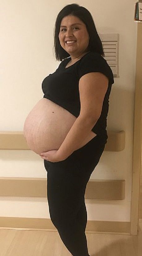 Lizeth w ciąży