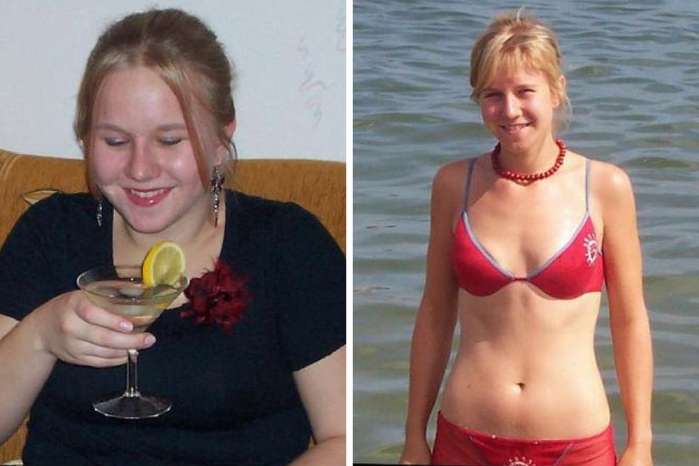 A. Netter przed i po metamorfozie