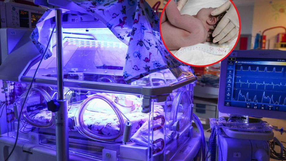 Skandal na porodówce w Krakowie. Interweniował Rzecznik Praw Pacjenta