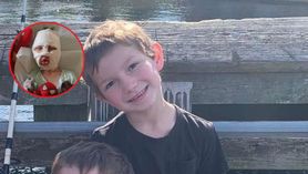 6-letni chłopiec ma poparzoną twarz po uderzeniu płonącą piłką tenisową. "Mój syn był zastraszany przez rok"