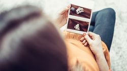 USG w ciąży - opis badania, ocena rozwoju ciąży