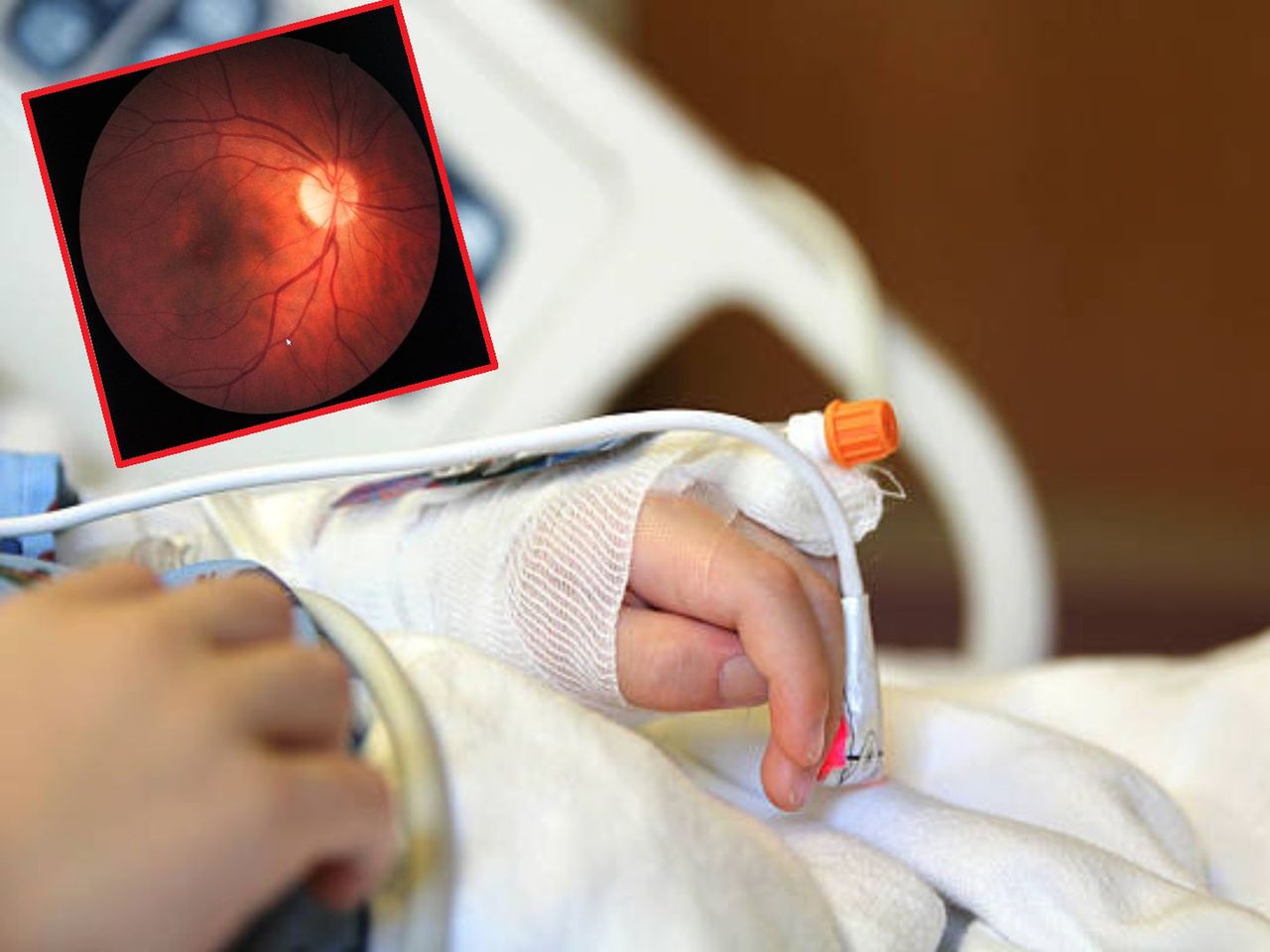 Prysnął siostrze w oko detergentem. 3-latka może stracić wzrok