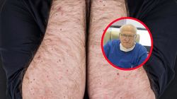 Coraz więcej chorych Polaków. "Przypominam, że na odrę się umiera"