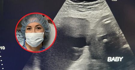 Znajdowała się w brzuchu ciężarnej. Rosła szybciej niż dziecko