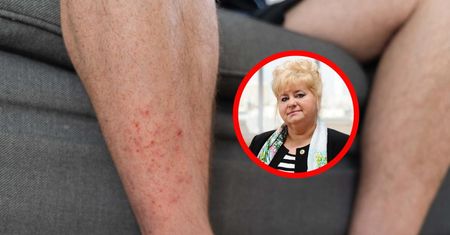 Wysyp zakażeń. "To dziś drugie najczęstsze infekcje po COVID-19"