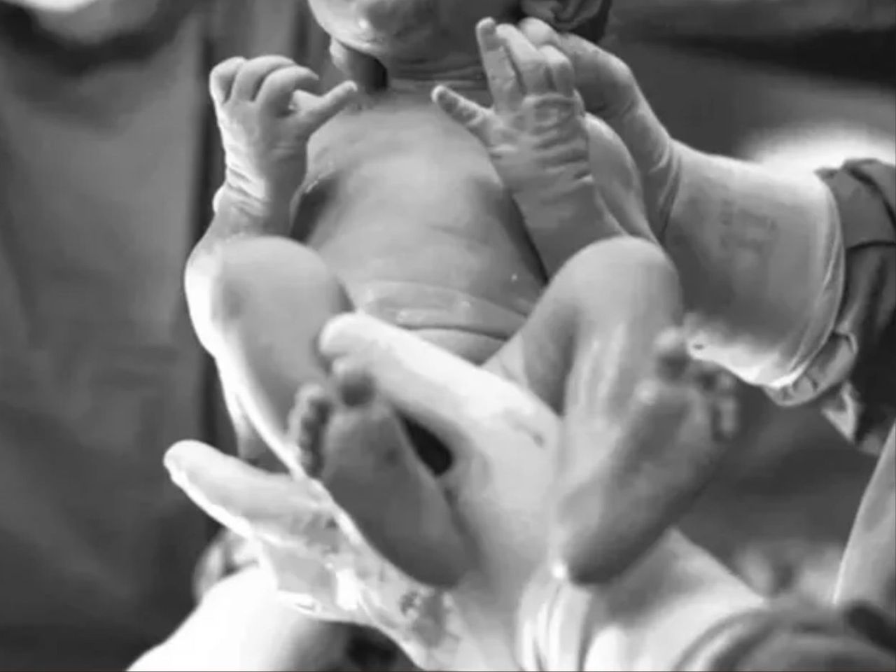 Horror podczas porodu. Dziecku urwała się głowa