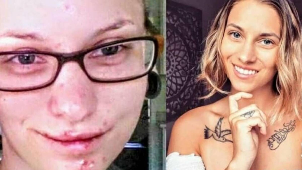 Narkomanka przeszła metamorfozę. Jest nie do poznania