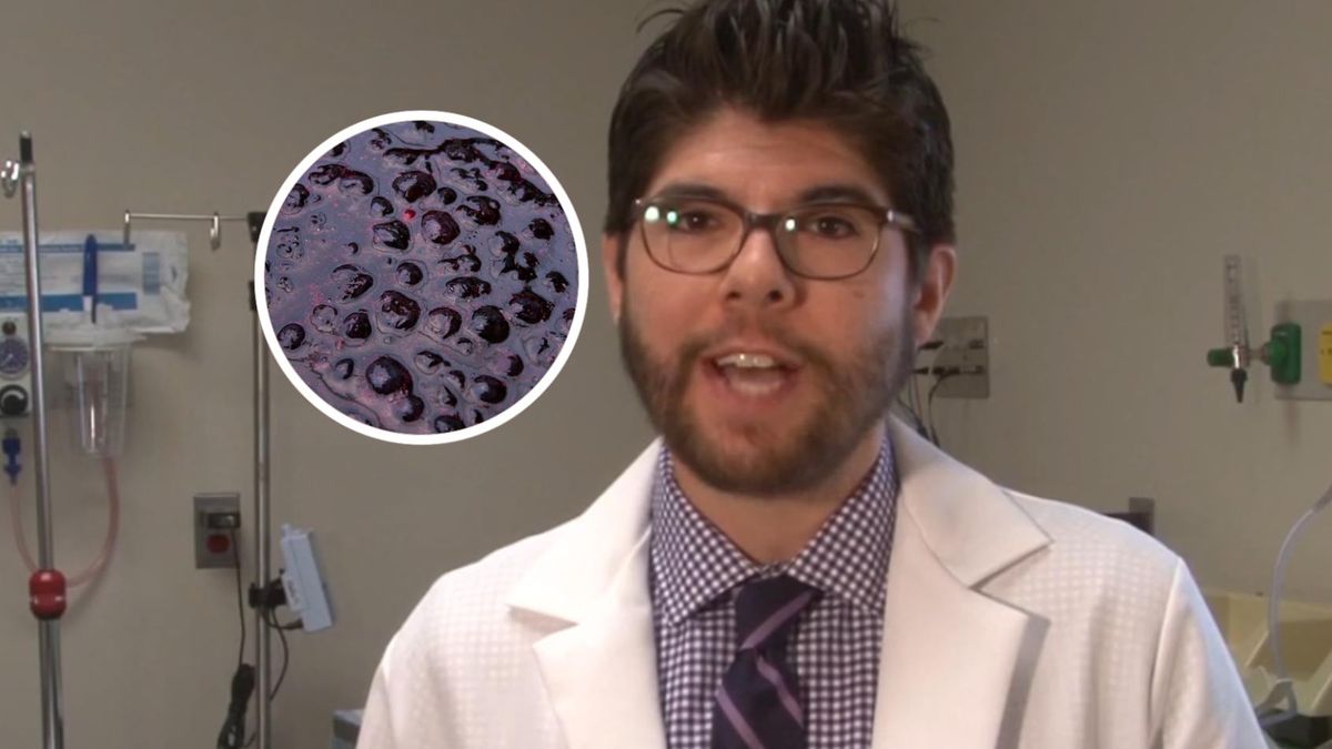 Borówki to jedne z najlepiej przebadanych owoców pod względem ochrony wątroby