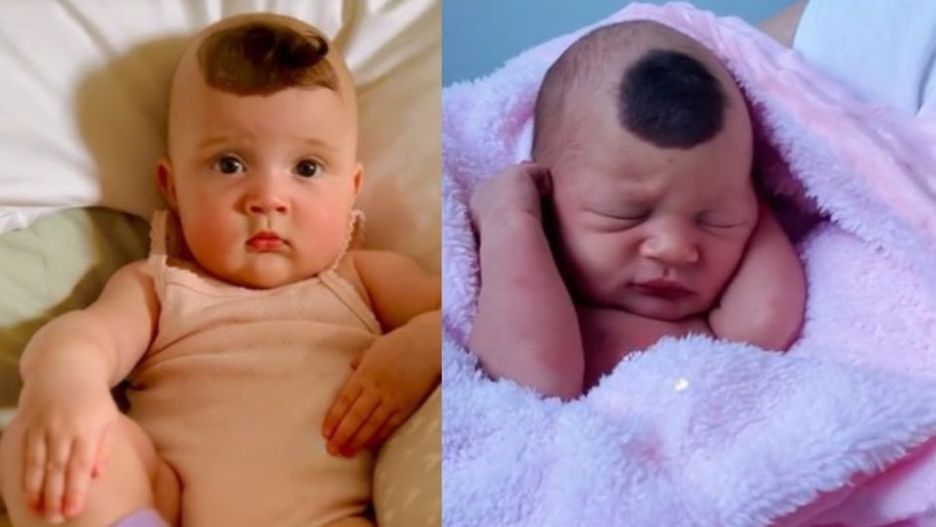 Dziewczynka urodziła się z nietypowym znamieniem. Na głowie ma "róg jednorożca"