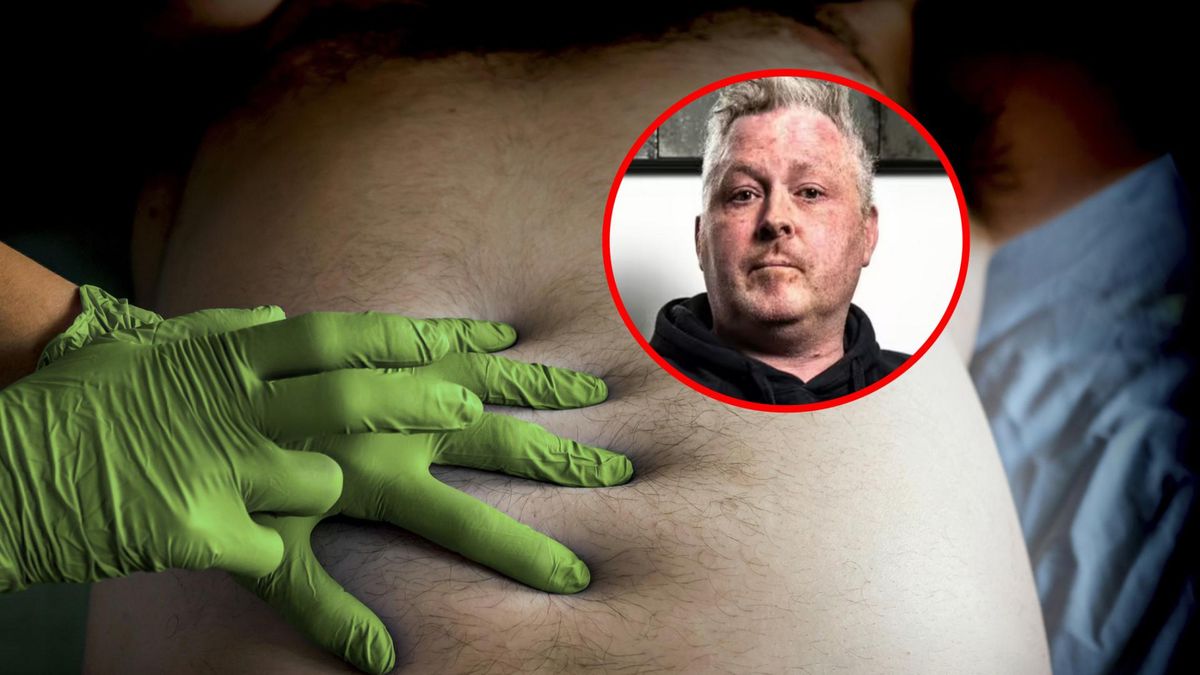 Robert Fisk walczy z rakiem jelita grubego