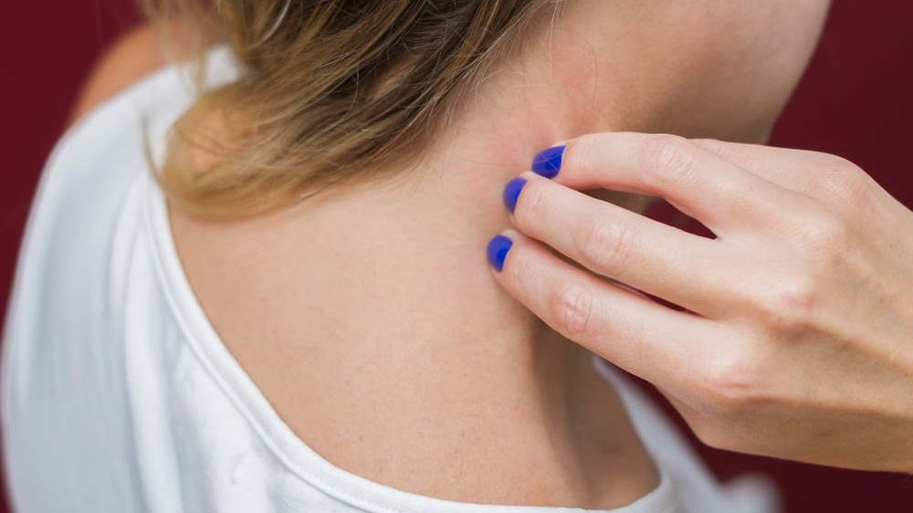 Objawy choroby widać na twarzy. Mogą świadczyć o chorej wątrobie