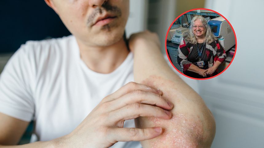 Stan skóry wpływa na nasze zdrowie. Uszkodzenia sprzyjają cukrzycy, demencji i zawałom