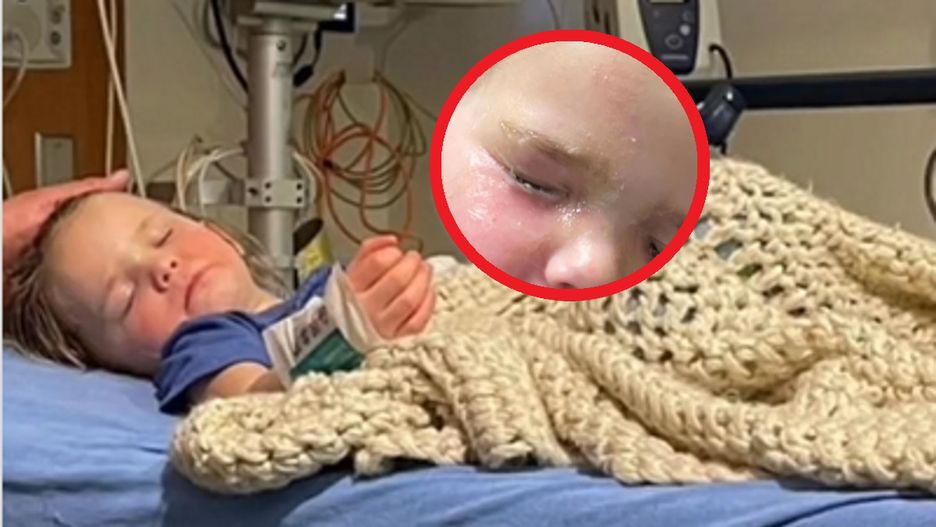 4-latka skleiła sobie oczy. Mocny klej nie chciał puścić