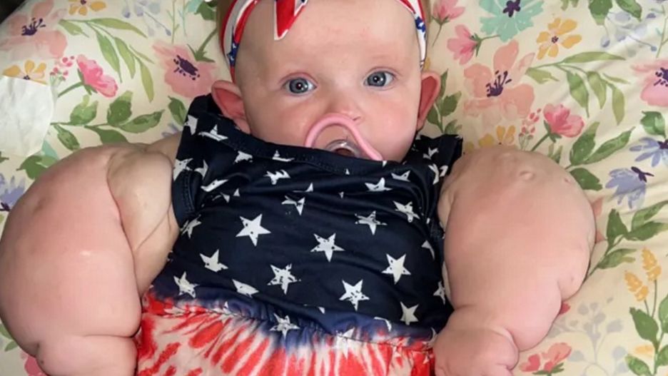 Miała niewielkie szanse na przeżycie. Dziś uśmiech nie schodzi jej z twarzy