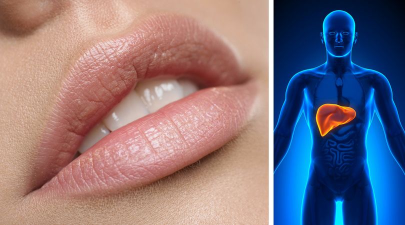 Okazuje się, ze kolor ust może świadczyć o stanie twojego zdrowia