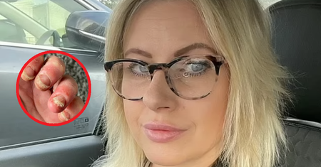 Uwielbiała manicure hybrydowy. Dziś z trudem porusza palcami