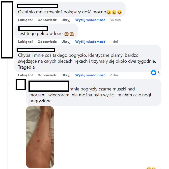 Takie są skutki pogryzienia przez owady