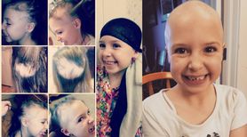 7-latka w miesiąc straciła wszystkie włosy. Mama znalazła rozwiązanie na pozbycie się jej kompleksów