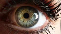 Tęczówka - budowa i funkcje, zapalenie