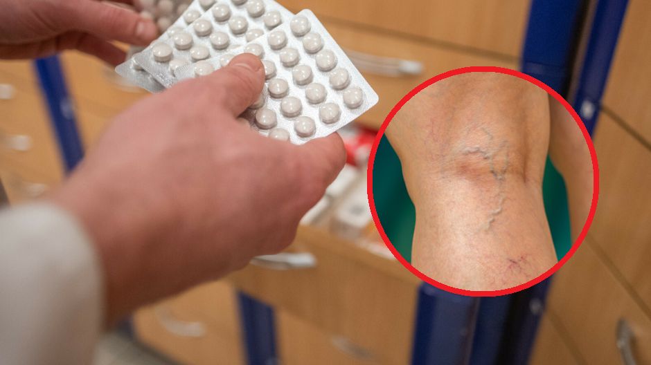 Antykoncepcja hormonalna podnosi ryzyko choroby zakrzepowo-zatorowej