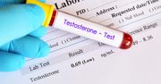 Testosteron - rola, badanie, nadmiar, niedobór