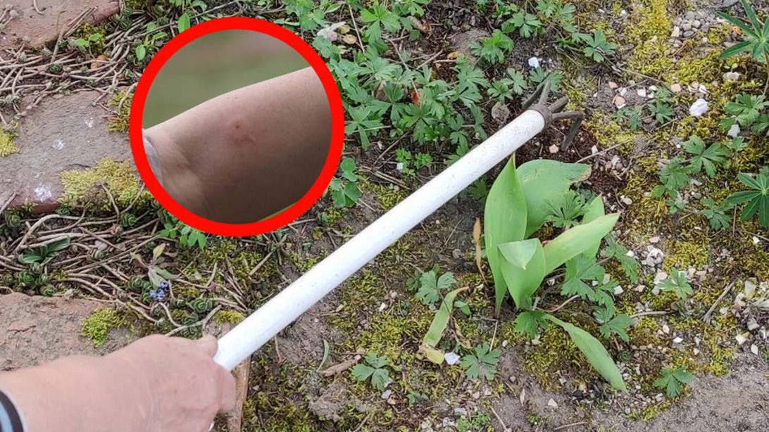 Uważaj podczas prac w ogrodzie. Kontakt z tymi owadami może skończyć się wstrząsem anafilaktycznym