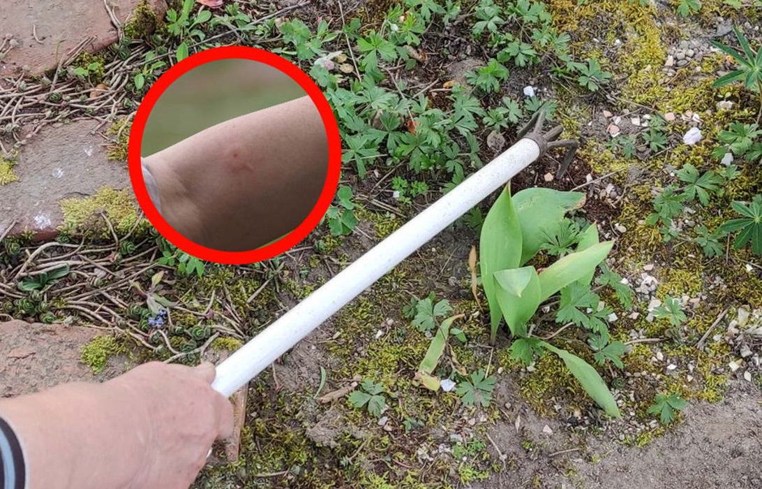 Daje najbardziej bolesne użądlenie. Ma więcej toksyn niż jad osy