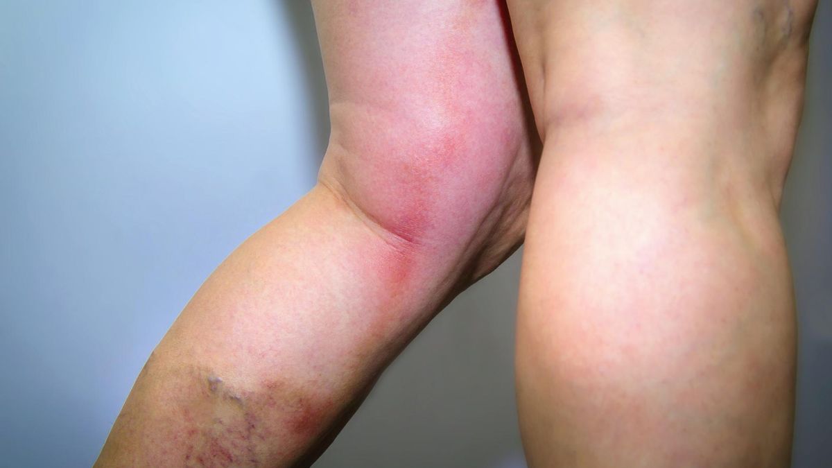 Długotrwała ekspozycja na zanieczyszczenia powietrza ma złożony wpływ na organizm