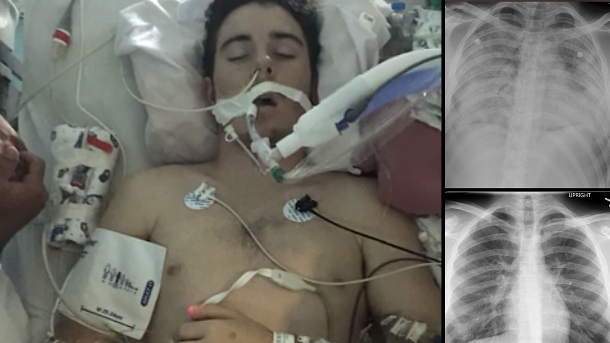 facebook / Coraz więcej chorób płuc po e-papierosach