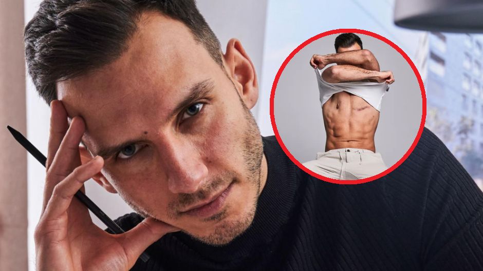 Adrian Szałek zachorował na raka piersi. Teraz zachęca do profilkatyki: "Wcześnie wykryte nowotwory są w dużym odsetku wyleczalne"