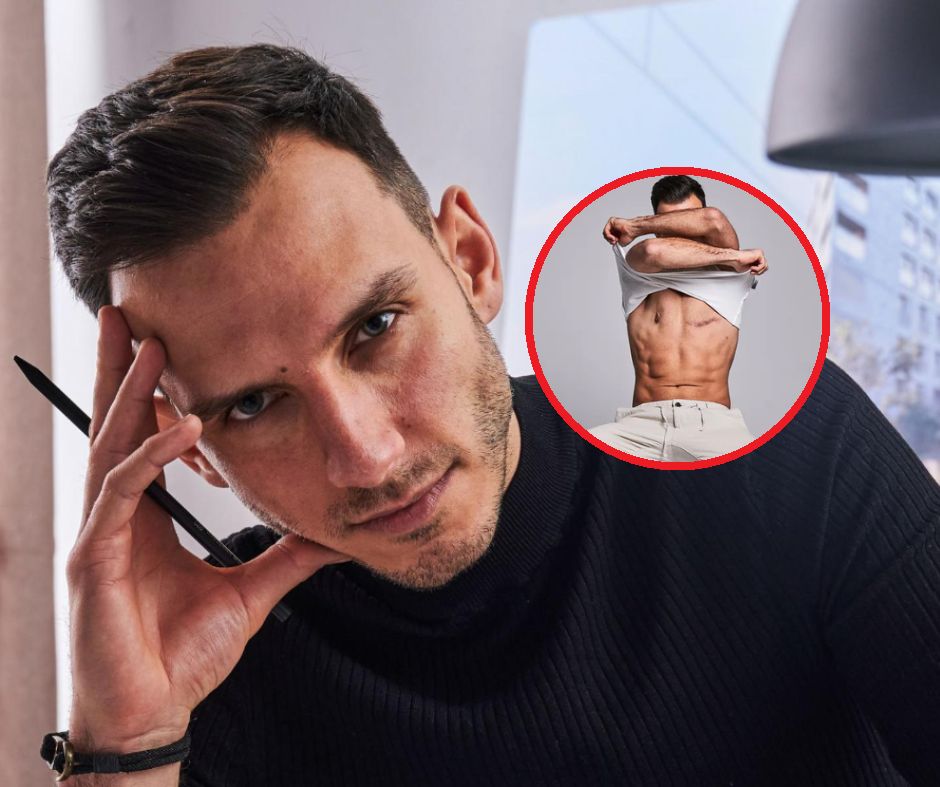 Adrian walczy z rakiem piersi. "Człowiek zmienia myślenie, kiedy staje z widmem śmierci twarzą w twarz"