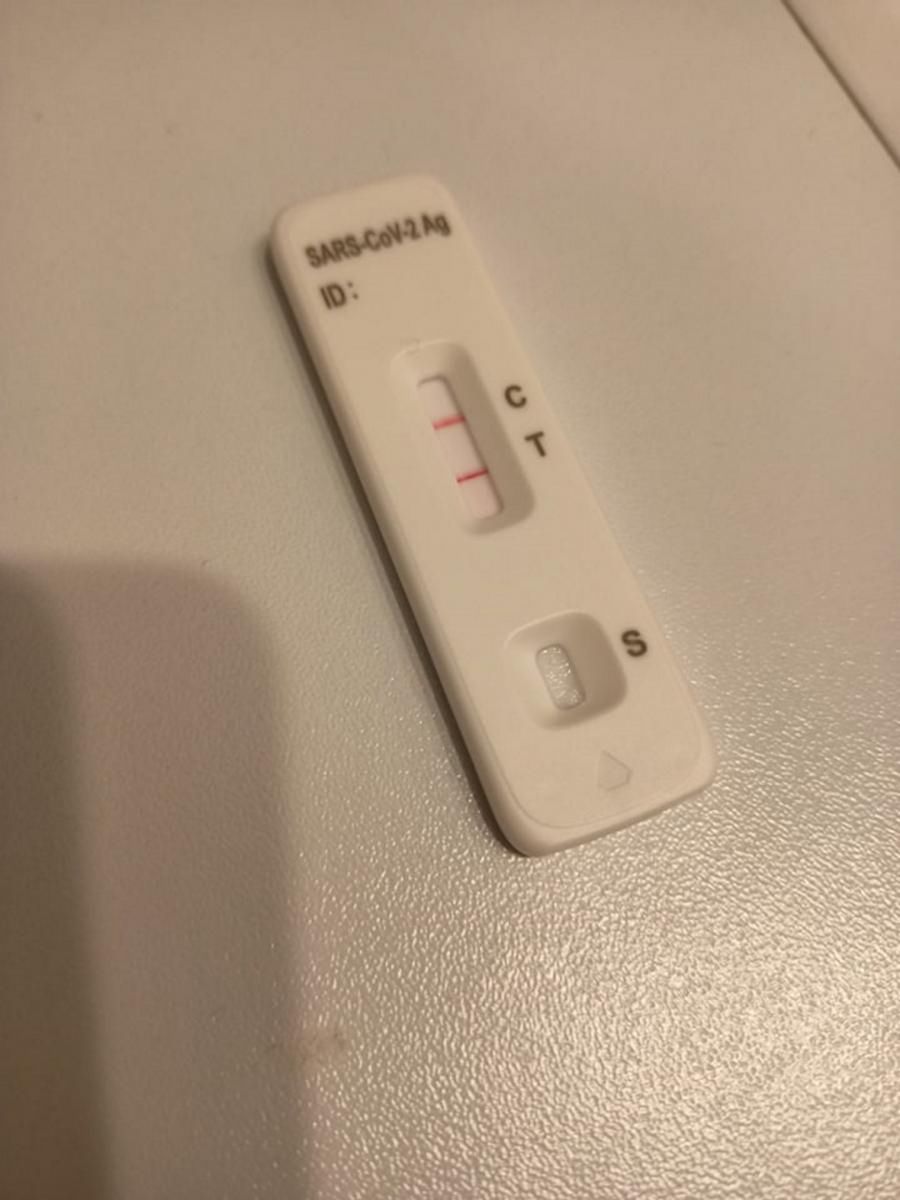 Test na koronawirusa SARS-CoV-2