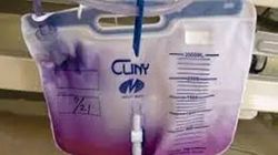 Niezwykły przypadek 76-latki. Jej mocz wyglądał jak denaturat