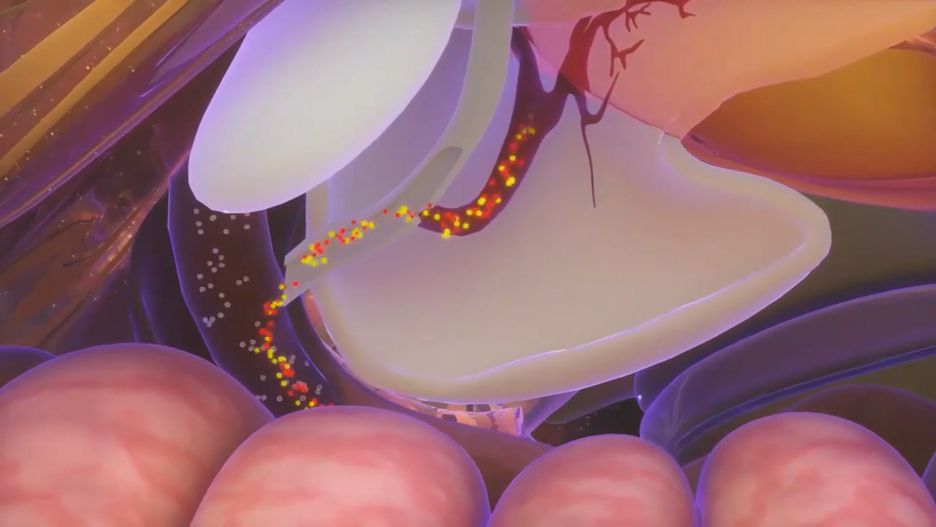 5 produktów, które szkodzą trzustce