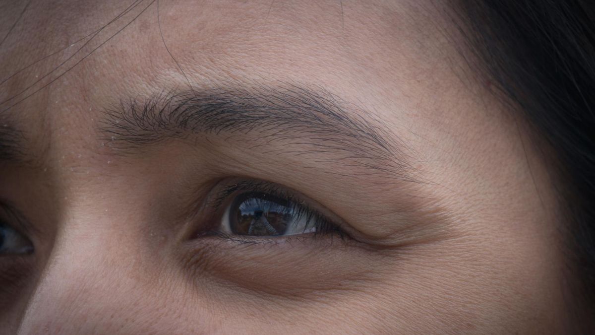 Cienie pod oczami jako objaw choroby