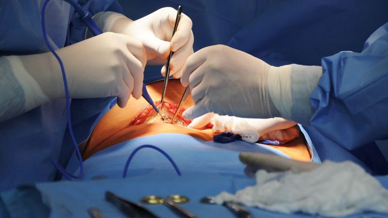 To w Polsce pierwsza taka operacja. Poznańscy lekarze odnieśli sukces na skalę światową